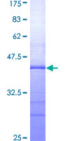 12.5% SDS-PAGE Stained with Coomassie Blue.
